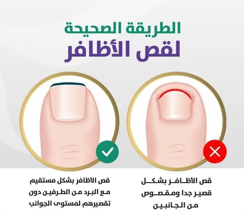 صورة: التقليم